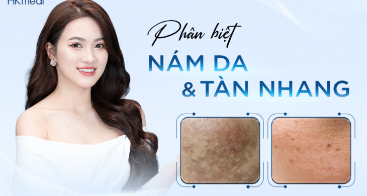 B3 - T4 Phân biệt nám da - tàn nhang