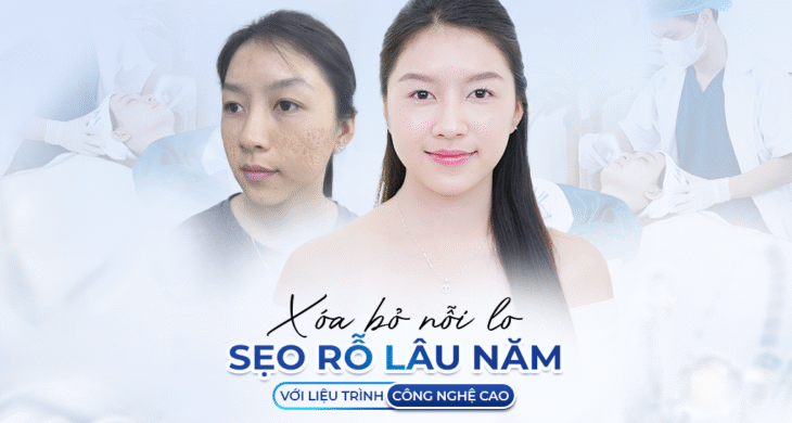 250423 Dương web sẹo rỗ resize - Khánh