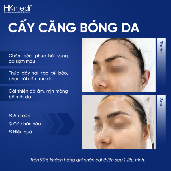 260816 Hậu web ảnh DV căng bóng - Khánh