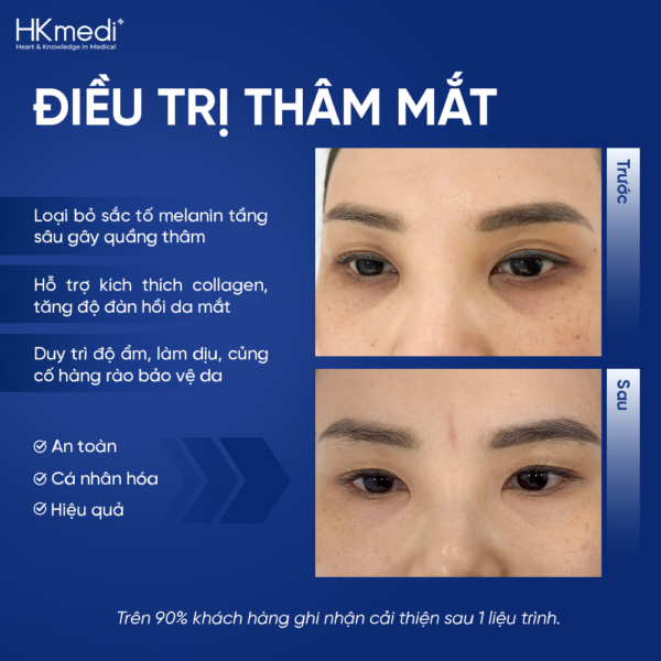 260816 Hậu web ảnh DV thâm mắt - Khánh