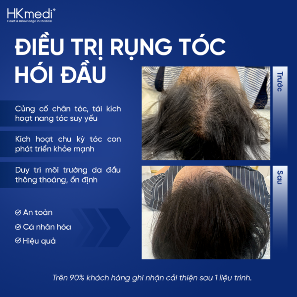 260816 Hậu web ảnh DV tóc - Khánh