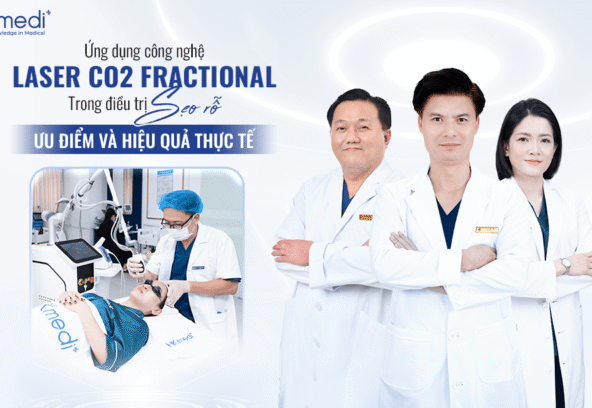 des theo mẫu-min