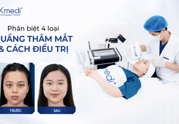 250909 Hồng web thâm mắt Khánh 01 (1)-min