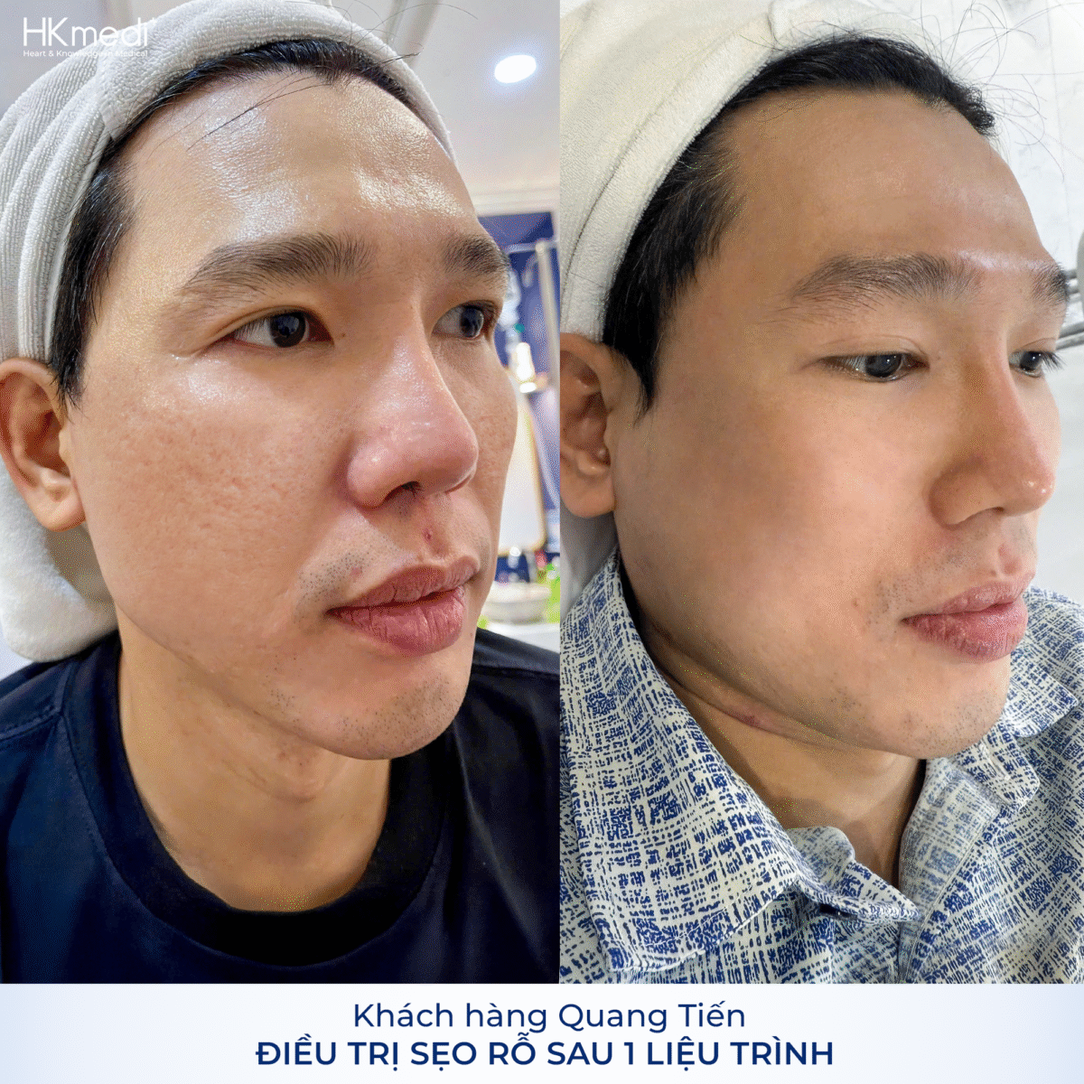 Artboard 1 copy 3 (3)