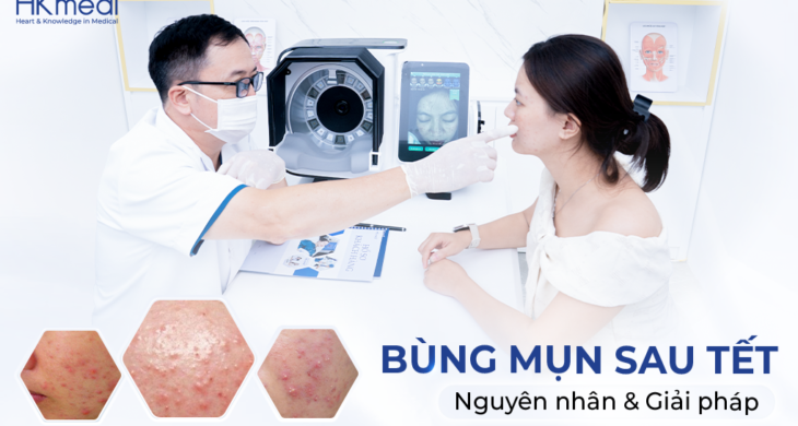 260227 Hồng web mụn Khánh 01