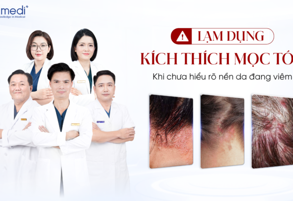 260917 Nam Wep 106 - Khánh 1